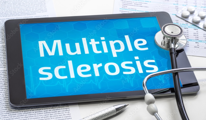 Multiple Sclerosis (MS) | Types, Causes, Symptoms & Treatment ...