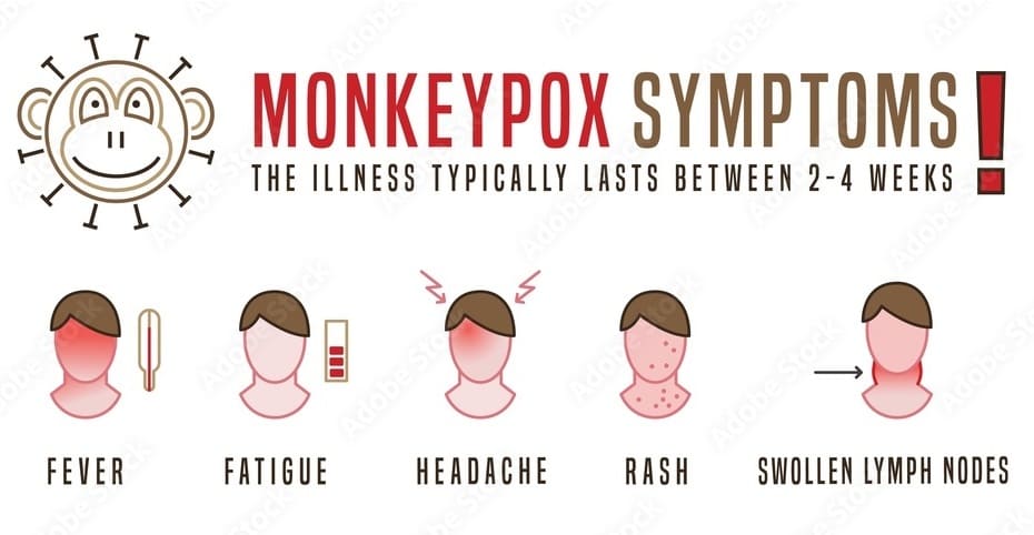 Monkeypox