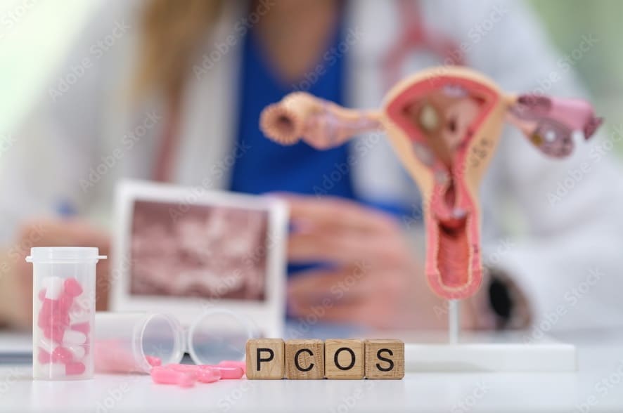 PCOS