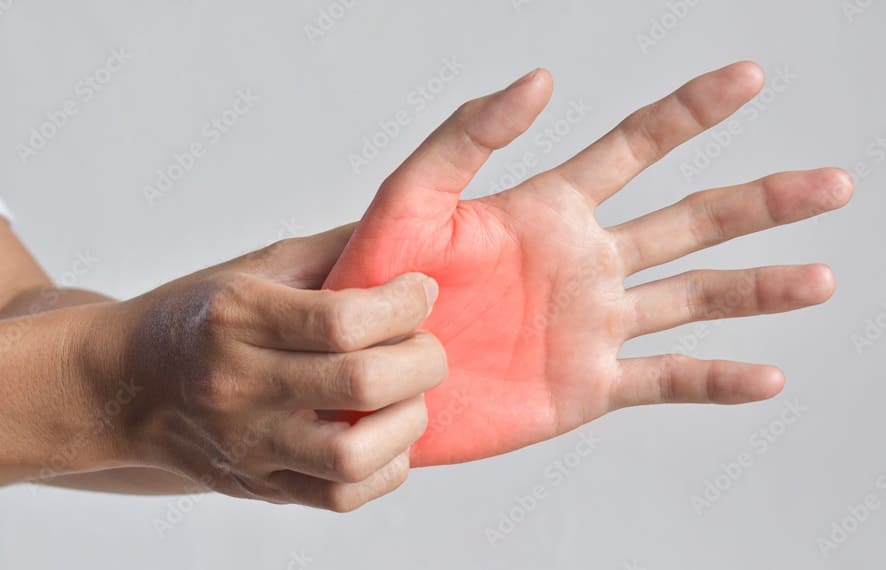 Itchy Palms