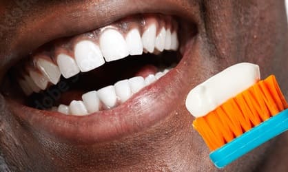 Black Gums