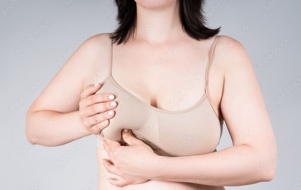 Sagging Breasts