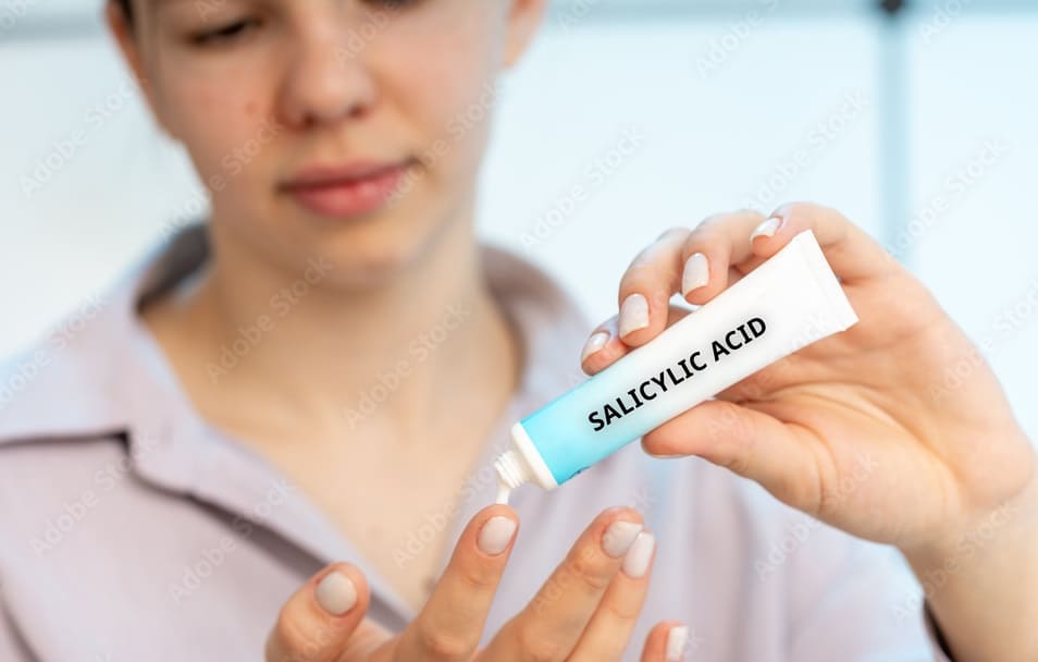Salicylic Acid