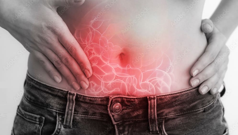 Appendicitis