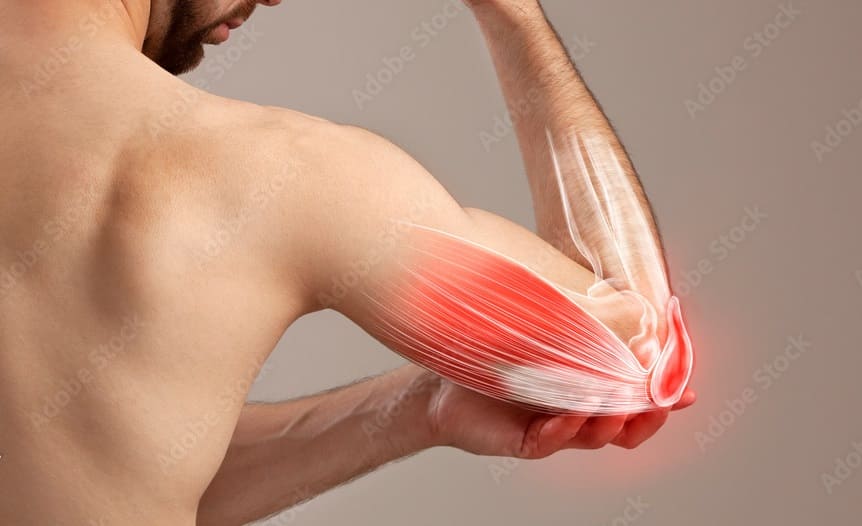 Arm Pain