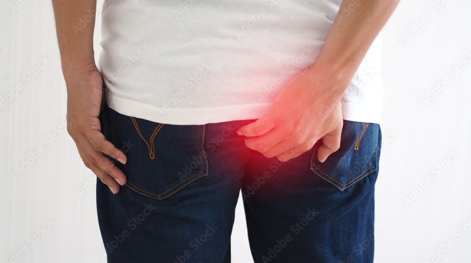 Anal Cancer