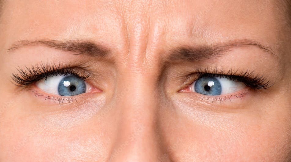 Squint Eyes