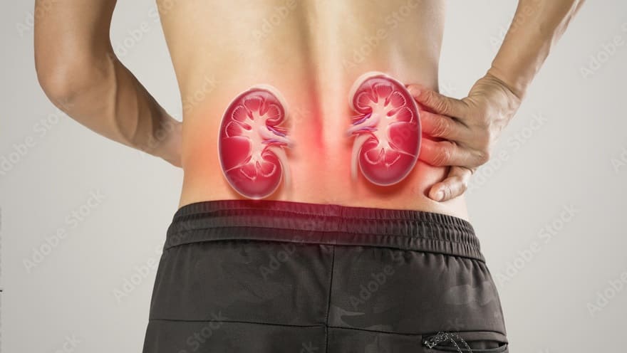 Kidney Pain