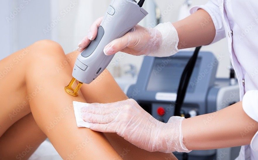 Laser Hair Removal